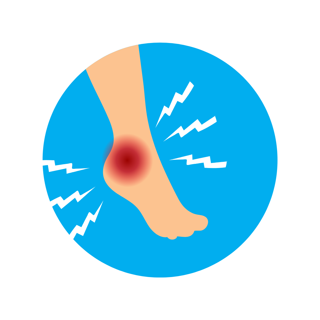 Preventing Blisters